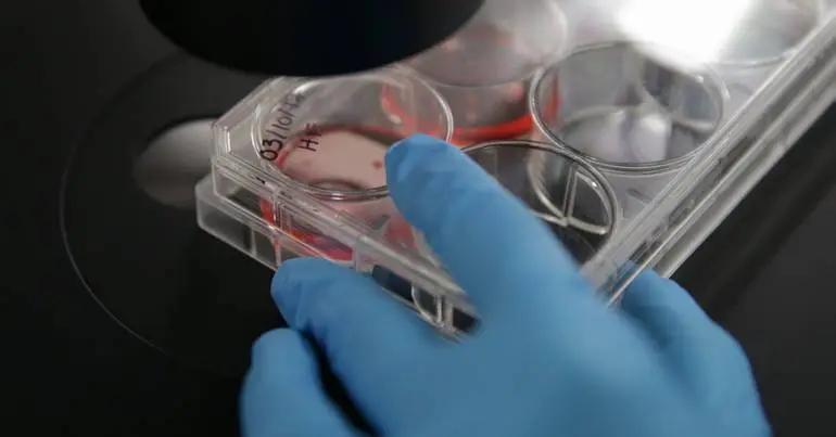 Coimbra descobre papel de proteína na epilepsia